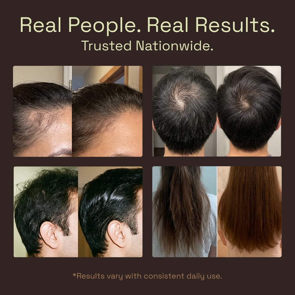 The Hair Density Oil